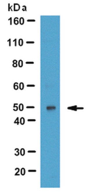 Anti-LYAR Antibody (Ly1 Antibody reactive clone) from rabbit, purified by affinity chromatography