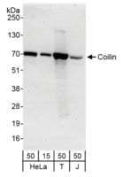 Rabbit anti-Coilin Antibody, Affinity Purified Powered by Bethyl Laboratories, Inc.