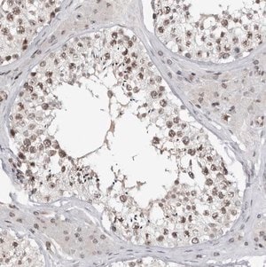 Anti-TRIM66 antibody produced in rabbit Prestige Antibodies&#174; Powered by Atlas Antibodies, affinity isolated antibody, buffered aqueous glycerol solution
