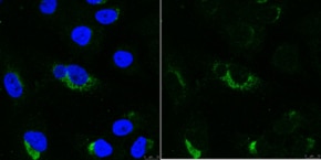 Anti-dsRNA Antibody, clone rJ2 culture supernatant, clone rJ2, from mouse