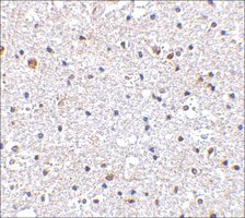 Anti-PD-1 (ab1) antibody produced in rabbit affinity isolated antibody, buffered aqueous solution