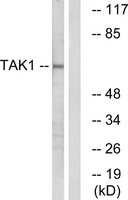 Anti-TAK1 antibody produced in rabbit affinity isolated antibody