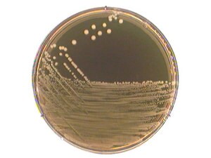 M 17 agar acc. to TERZAGHI suitable for microbiology