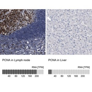 Anti-PCNA antibody produced in rabbit Prestige Antibodies&#174; Powered by Atlas Antibodies, affinity isolated antibody, buffered aqueous glycerol solution, ab1