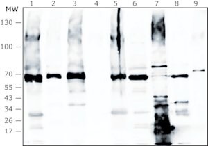 Anti-Enterococcus faecalis antibody produced in rabbit IgG fraction of antiserum