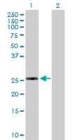 Anti-RPL10L antibody produced in mouse purified immunoglobulin, buffered aqueous solution