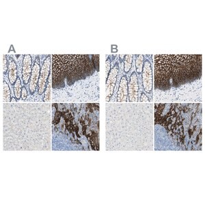 Anti-DSC2 antibody produced in rabbit Prestige Antibodies&#174; Powered by Atlas Antibodies, affinity isolated antibody, buffered aqueous glycerol solution