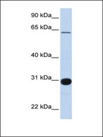 Anti-RALGPS1 antibody produced in rabbit affinity isolated antibody