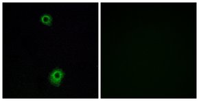 抗-HTR1B 兔抗 affinity isolated antibody