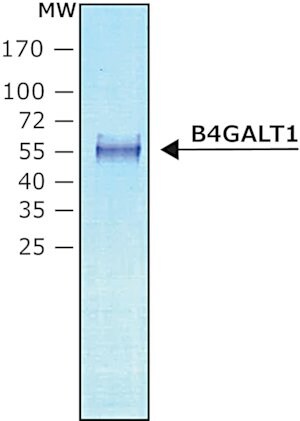 Beta-1,4-galactosyltransferase 1 B4GALT1 human recombinant, expressed in HEK 293 cells, 2000&#160;units/mg protein