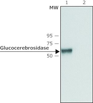 抗 葡萄糖脑苷脂酶（C 端） 兔抗 ~1&#160;mg/mL, affinity isolated antibody, buffered aqueous solution