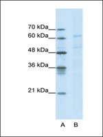 Anti-CACNB3 antibody produced in rabbit IgG fraction of antiserum