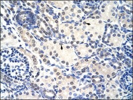 Anti-RNASEH2A antibody produced in rabbit affinity isolated antibody