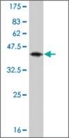 Monoclonal Anti-IL13 antibody produced in mouse clone 7E4, purified immunoglobulin, buffered aqueous solution