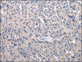 Anti-TOR1A affinity isolated antibody