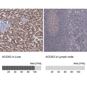 Anti-ACOX2 antibody produced in rabbit Prestige Antibodies&#174; Powered by Atlas Antibodies, affinity isolated antibody, buffered aqueous glycerol solution