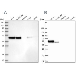 Anti-RCN1 antibody produced in rabbit Prestige Antibodies&#174; Powered by Atlas Antibodies, affinity isolated antibody, buffered aqueous glycerol solution