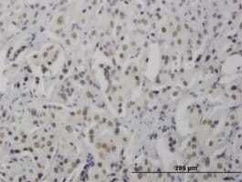 Monoclonal Anti-RNF168 antibody produced in mouse clone 3E1, purified immunoglobulin, buffered aqueous solution