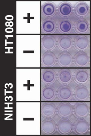 QCM ECMatrix细胞侵袭试验，24孔（8 &#181;m），比色法 The CHEMICON Cell Invasion Assay Kit uses a 24-well plate, with 8 um pores, which provides an efficient system for evaluating the invasion of tumor cells through a basement membrane model.