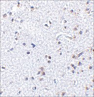 Anti-TSLP (ab1) antibody produced in rabbit affinity isolated antibody, buffered aqueous solution