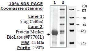 Cofilin 1 Active human recombinant, expressed in E. coli, &#8805;90% (SDS-PAGE)