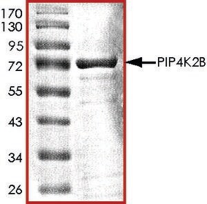 PIP4K2B, Active PRECISIO&#174; Kinase, recombinant