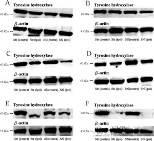 Anti-Tyrosine Hydroxylase Antibody, clone LNC1 ascites fluid, clone LNC1, Chemicon&#174;