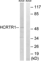 Anti-HCRTR1 antibody produced in rabbit affinity isolated antibody