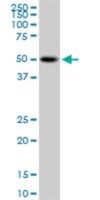 Monoclonal Anti-PSTPIP1 antibody produced in mouse clone 1D5, purified immunoglobulin, buffered aqueous solution