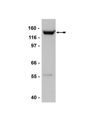 Anti-SMC2/hCAP-E Antibody serum, Upstate&#174;