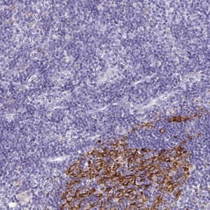 Anti-CDCA4 antibody produced in rabbit Prestige Antibodies&#174; Powered by Atlas Antibodies, affinity isolated antibody, buffered aqueous glycerol solution