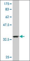 Monoclonal Anti-NDUFA2 antibody produced in mouse clone 6E7, purified immunoglobulin, buffered aqueous solution