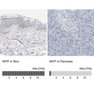 Anti-MITF antibody produced in rabbit Prestige Antibodies&#174; Powered by Atlas Antibodies, affinity isolated antibody, buffered aqueous glycerol solution